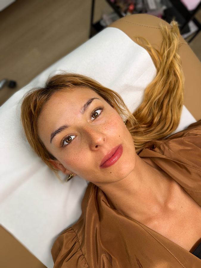 Taches de rousseur sur peau claire, cheveux roux