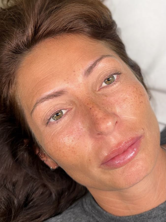 Taches de rousseur sur un visage mature